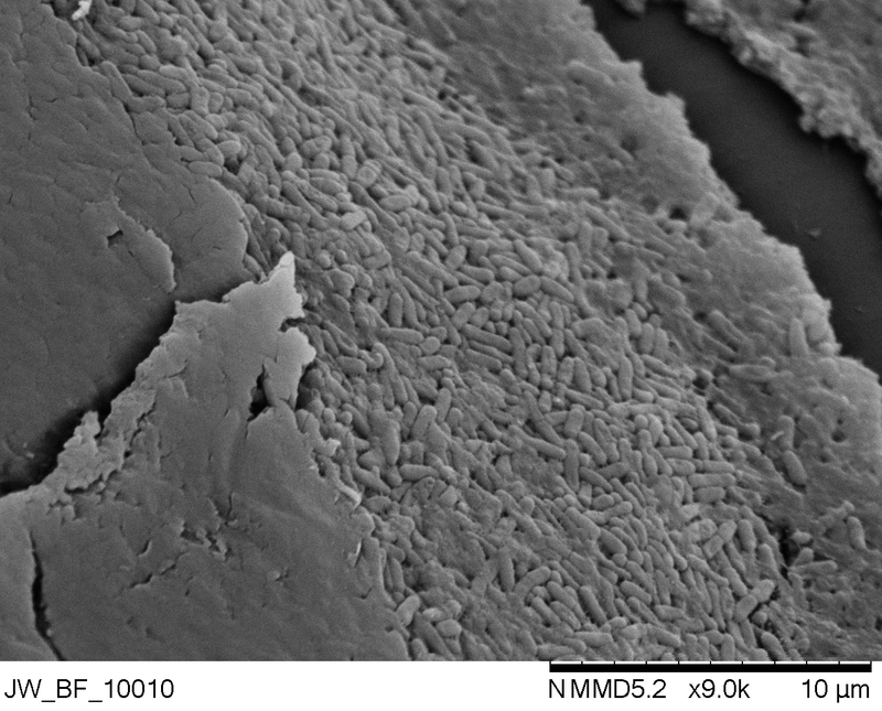 breaing down bacterial biofilm